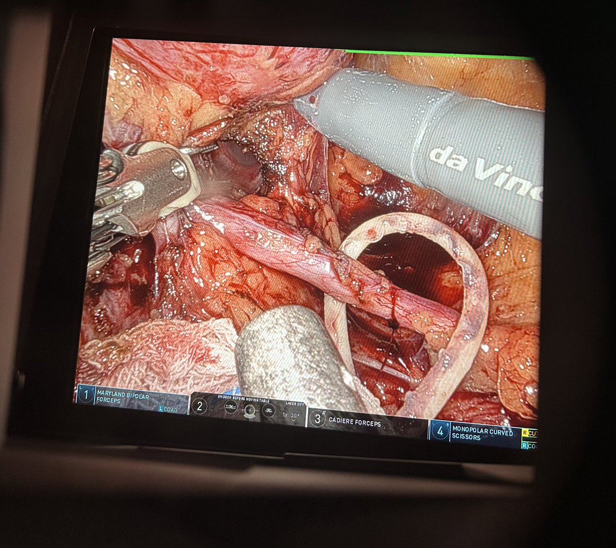 Yang Kunlin tweet media