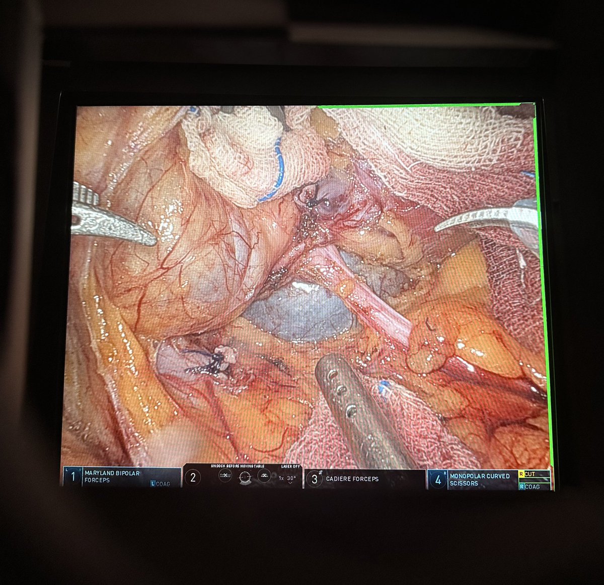 Yang Kunlin tweet media