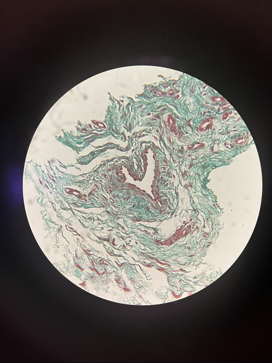 Diving towards the heart of synovium ✨

Amazing microscopic friday at <a href="/SYNGemBU/">SYNGem Biopsy Unit</a> - from MCP joint 🤍.
