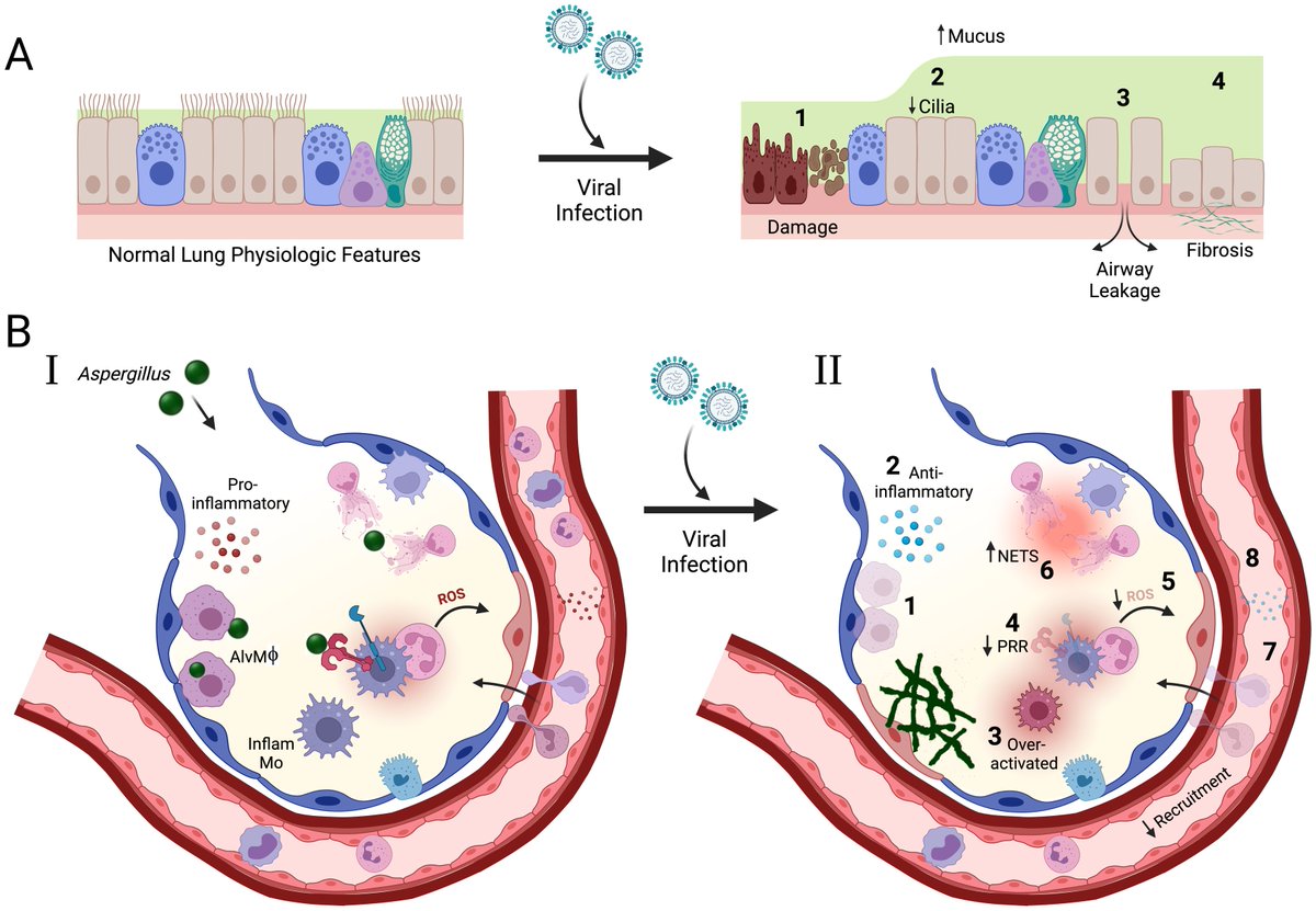 🔎 Coinfections in the lung: How viral infection creates a favorable environment for bacterial and fungal infections: plos.io/3nLHVLf