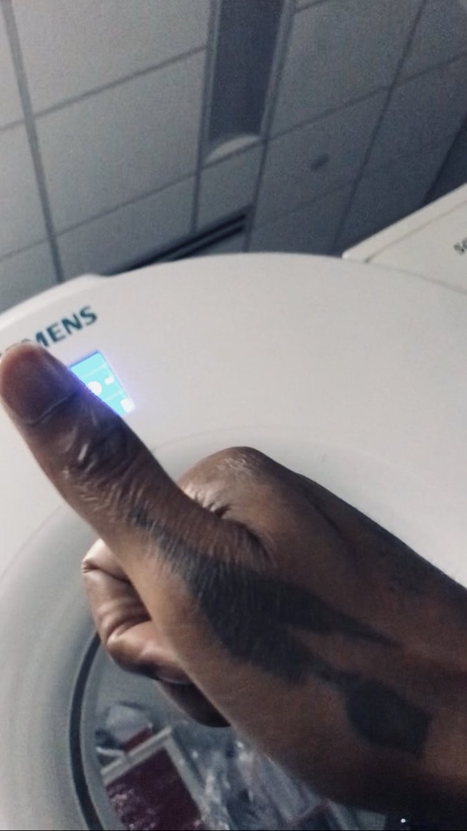 The2eyedman's tweet photo. DRY DIAGNOSIS: In the hospital getting examined, so far so good🌹🥂 out healthy! Only slight high b.p. Glory be to God✊🏽👑
#Truth #Jesus #Jesonianity #SuperlativeOrderSuperhuman #ShogunOftheUS #Killuminati #StopGunControl #ProGun #StopElectronicBasedMindControl #JustKOSweCare https://t.co/CVGYD0dyEN