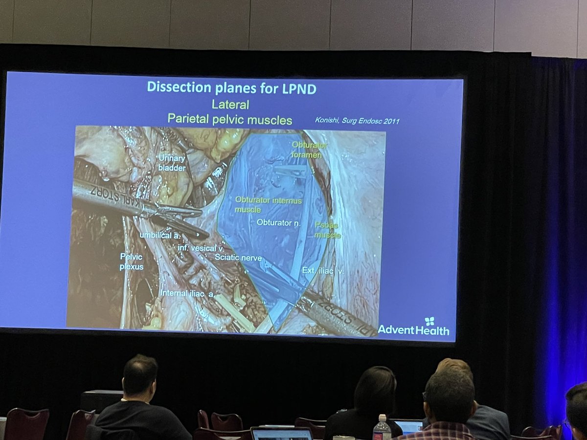 JohnRTMonsonMD's tweet image. @TAMISYoda discusses #LLND for Rectal cancer #occ2023 Any takers out there? @R_Perez_MD @georgenassifjr @ColonCancerDoc @SeanLangenfeld @AllawiAIA