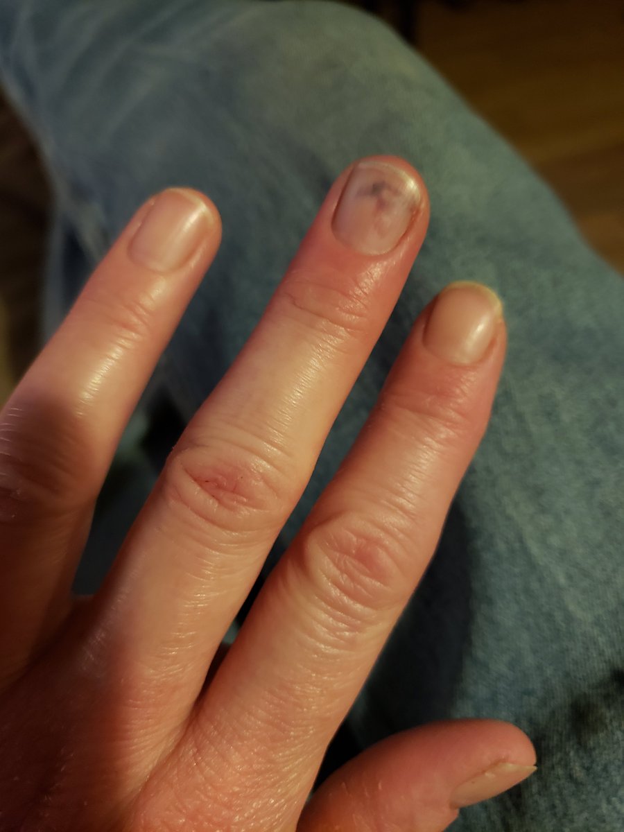 candeebabe1979's tweet photo. A good day then this happened 😢 https://t.co/UWQC6yksPR