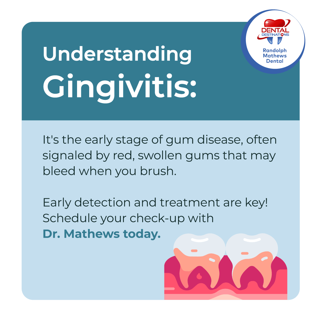 RMathewsDental's tweet photo. Understanding Gingivitis: The early stage of gum disease, marked by red, swollen gums that may bleed when you brush. Early detection and treatment are key! Schedule your check-up with Dr. Mathews today. 🦷💙 #GingivitisAwareness #OralHealth https://t.co/IxMsKXaEK7