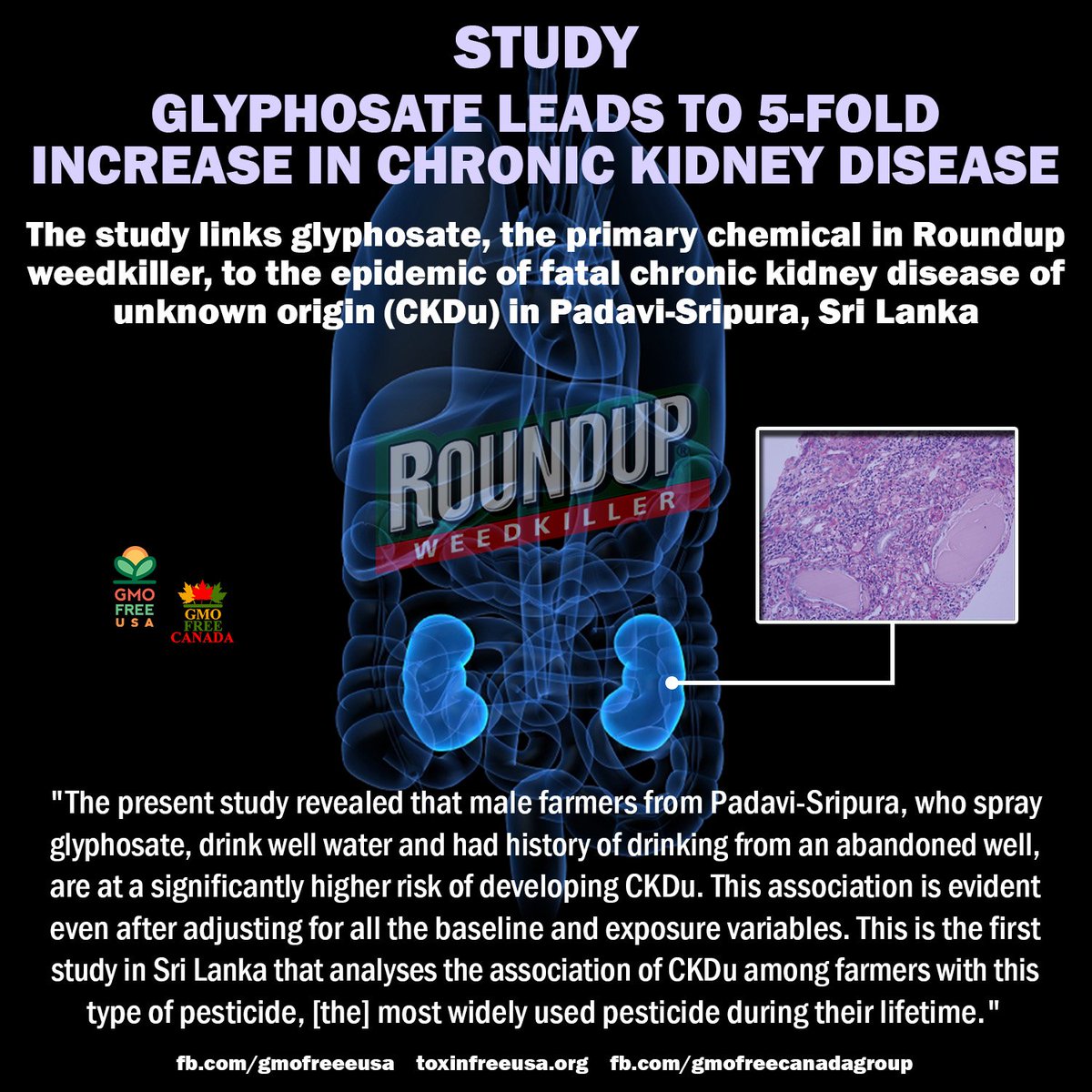 GMOFreeUSA's tweet photo. Study: #Glyphosate Leads to 5-Fold Increase in Deadly Kidney Disease Risk: https://t.co/iwQKxJzl58
Take action to ban glyphosate: https://t.co/1DH3drYtIB https://t.co/uILgQu5O4K