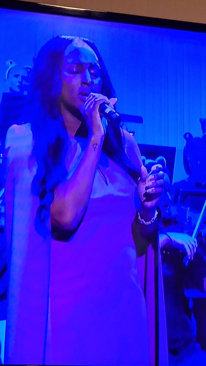 Sad to see <a href="/alexandramusic/">Alexandra Burke</a> on #childreninneed tonight singing to help young kids, shame she thought it ok to mock people, like me with epilepsy, a few years ago!! All for the camera huh?? 😭😭 #BBCCiN
dailystar.co.uk/news/latest-ne…