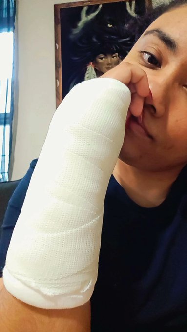 New cast and this shit hurt odee https://t.co/skTH4dGBI5<a href="/tag/mvsales"class="tags"><span>#mvsales</span></a>