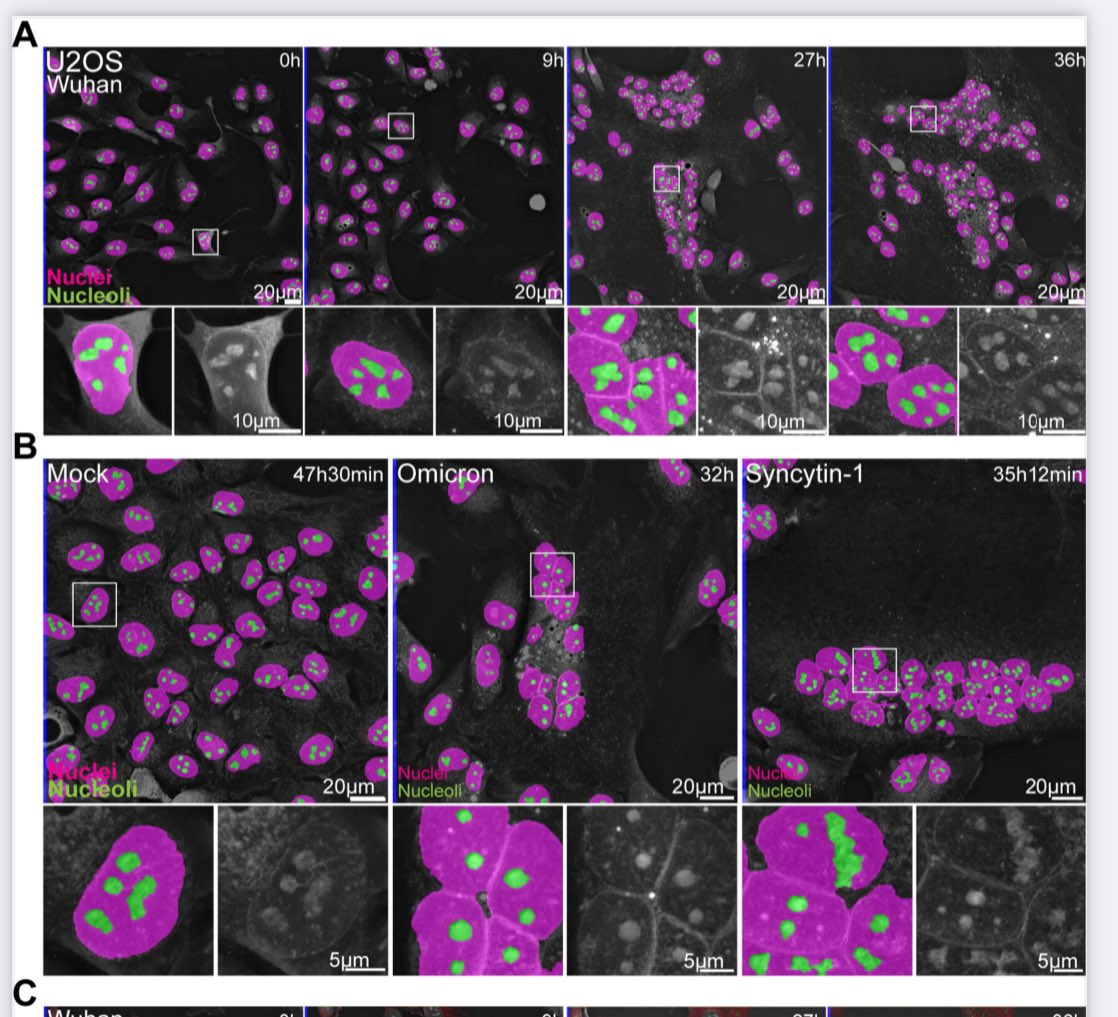 Nuclei (in pink) and nucleoli (in green) remained intact during infection. Noted was the formation of clusters of nuclei in infected cells