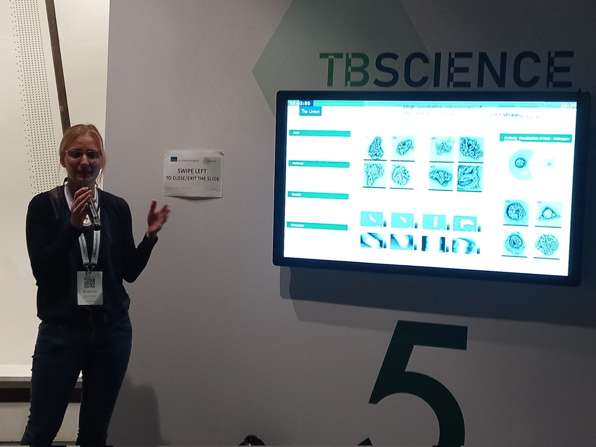 MathaChipinduro's tweet photo. An absolute pleasure to finally meet Prof Susanne Homolka @UnionConference presenting fascinating results on differences in structural Mtb strains using high resolution microscopy
Can't wait for more results on associations #virulence #transmissibity
@FZBorstel  @KatharinaKranz4 https://t.co/Tc7OkRBx20