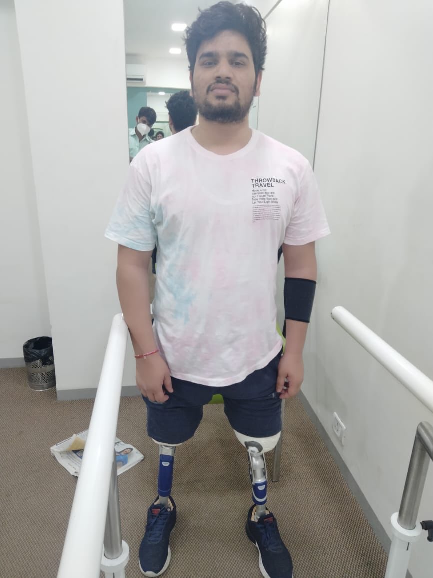 AkashPratap37's tweet photo. Finally PhD viva done😃, my trajectory was slightly different, I was able to learn walk again on prosthesis and switch from wet lab work to computational data mining. 
Thank you to IGIB team who helped us reach this milestone.
@CSIR_IND @IGIBSocial @AcSIR_India @MSJEGOI https://t.co/1vVcJizxq3