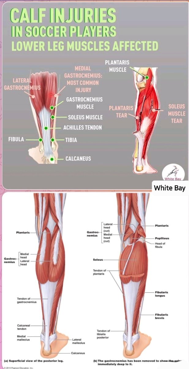 The figure first from above,showing the common sites of injury in the lower legs of soccer players, and the other figure beautifully demonstrating the calf muscles both superficial and the deep muscles👍👏👏