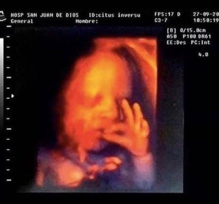 Her: I'm pregnant with your baby..

Me: How do I know it's mine?

Her: