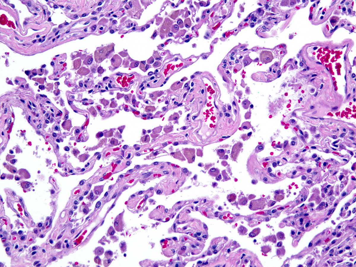 Sanjay Mukhopadhyay tweet media