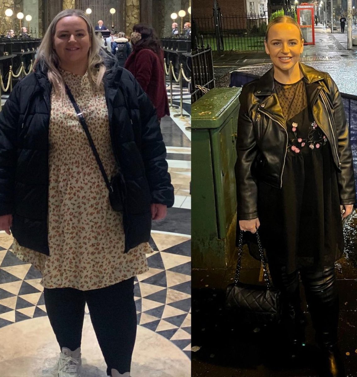 REPOST @wlswithkatiehannah 'In 10 days it marks the 2 year anniversary of the start of my LRD in prep for my gastric bypass surgery. What a journey it’s been! Over 10 stone weight loss....' Inspirational Katie 🎉 #GivingBackLives #BeforeAndAfter
