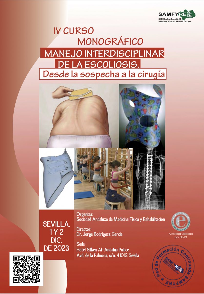 Sólo dos semanas para empezar la IV edición del Curso Monográfico de Escoliosis. Deseando recibiros en Sevilla!!.  Accede a toda la información a través del siguiente link cursosmce.es/cursos-seminar…