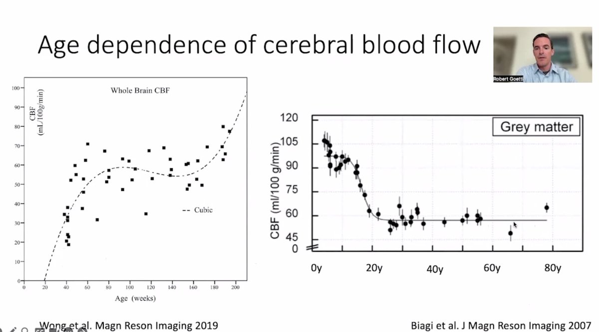 JordiRoldanB's tweet image. Excellent talk and related tips from
@robgoetti
of a tricky topic in pediatrics, perfusion imaging #SPIN2023