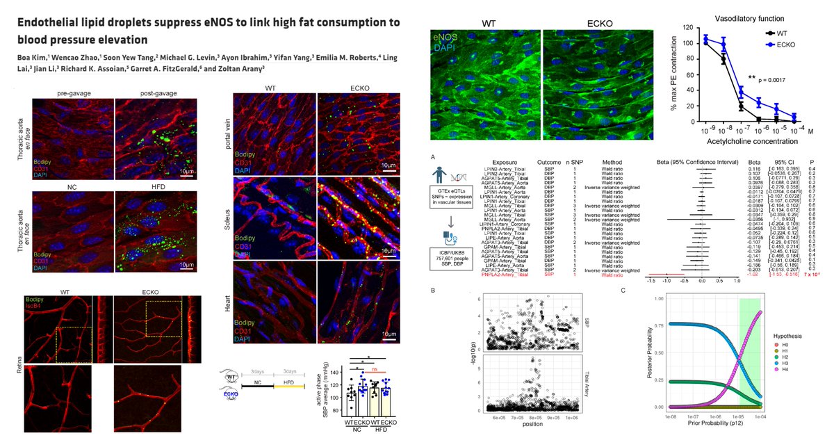 Hao Yin (@haoyin20) on Twitter photo How #Obesity➡️#Hypertension?
Excess #LipidDroplet⏬eNOS in macro-/microvascular #EndothelialCells, via
1⃣⏬eNOS mRNA stability
2⃣⏫MCP1 autocrine
EC Atgl KO🐭->
Hypertension ~10 mmHg SBP
⏫Atherosclerosis (AAV8-PCSK9)
<a href="/AranyLab/">The Arany lab</a> <a href="/jclinicalinvest/">Journal of Clinical Investigation</a> 2023
www-jci-org.proxy1.lib.uwo.ca/articles/view/… How #Obesity➡️#Hypertension?
Excess #LipidDroplet⏬eNOS in macro-/microvascular #EndothelialCells, via
1⃣⏬eNOS mRNA stability
2⃣⏫MCP1 autocrine
EC Atgl KO🐭->
Hypertension ~10 mmHg SBP
⏫Atherosclerosis (AAV8-PCSK9)
<a href="/AranyLab/">The Arany lab</a> <a href="/jclinicalinvest/">Journal of Clinical Investigation</a> 2023
www-jci-org.proxy1.lib.uwo.ca/articles/view/…