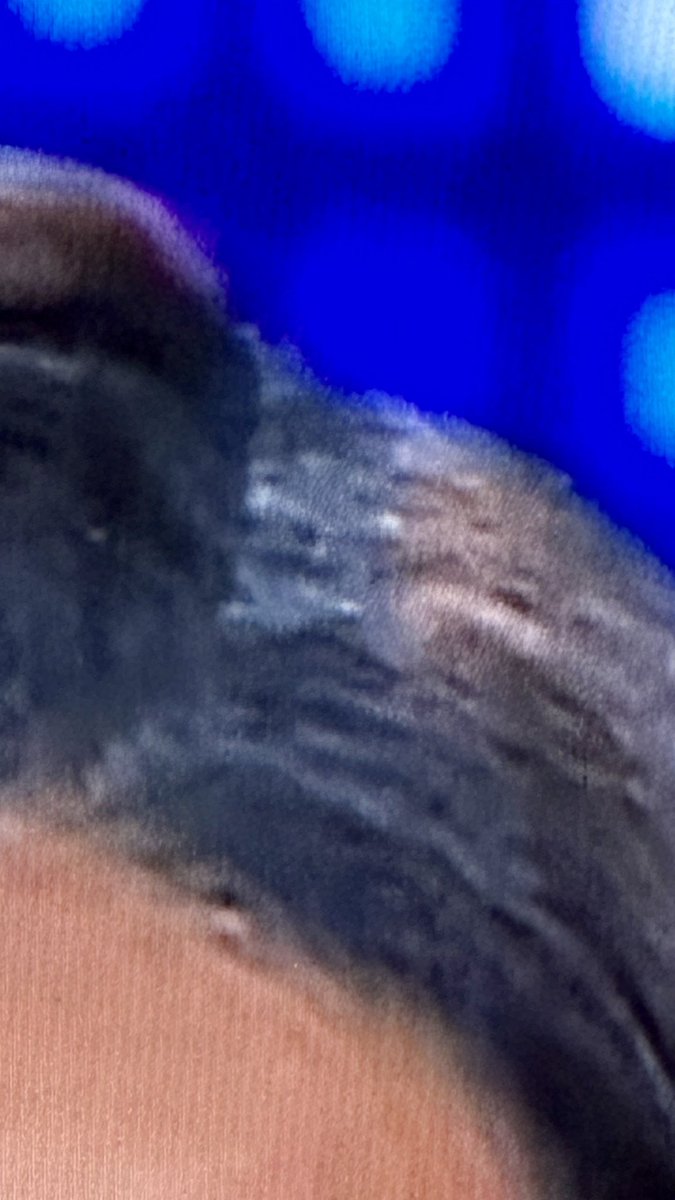 EffU66901617's tweet photo. Someone deserves to get their hair did! EffU @CNN https://t.co/5x7Lonsiez
