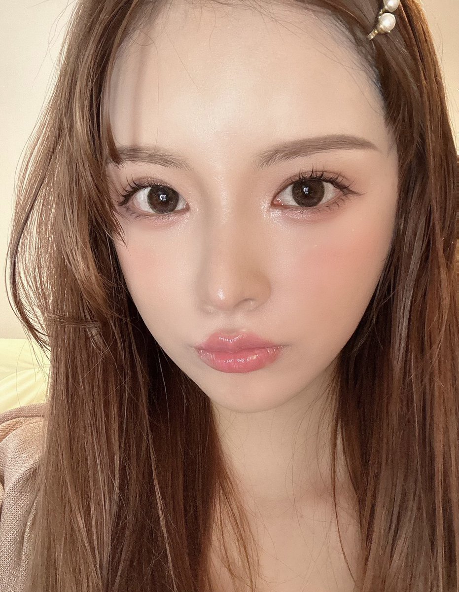 seeeraaamoon's tweet photo. 人中短縮ハイフとナノカレントを唇に当てる。この２つで人中短くなってぷるぷる唇になりました💋ダウンタイムもないのでおすすめです♡（人中短縮手術や唇ヒアルロン酸はしてないです） https://t.co/q42tkA9NCI