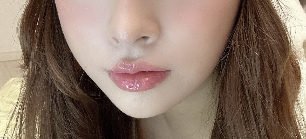 seeeraaamoon's tweet photo. 人中短縮ハイフとナノカレントを唇に当てる。この２つで人中短くなってぷるぷる唇になりました💋ダウンタイムもないのでおすすめです♡（人中短縮手術や唇ヒアルロン酸はしてないです） https://t.co/q42tkA9NCI