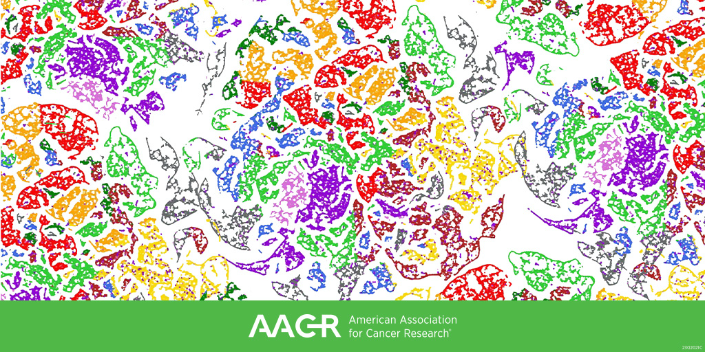 AACR's tweet photo. The final day of the AACR Special Conference on Endometrial Cancer—which includes sessions on immunotherapy and molecular mechanisms—will begin soon here in Boston.
#AACRec23 https://t.co/8aircr3jyL