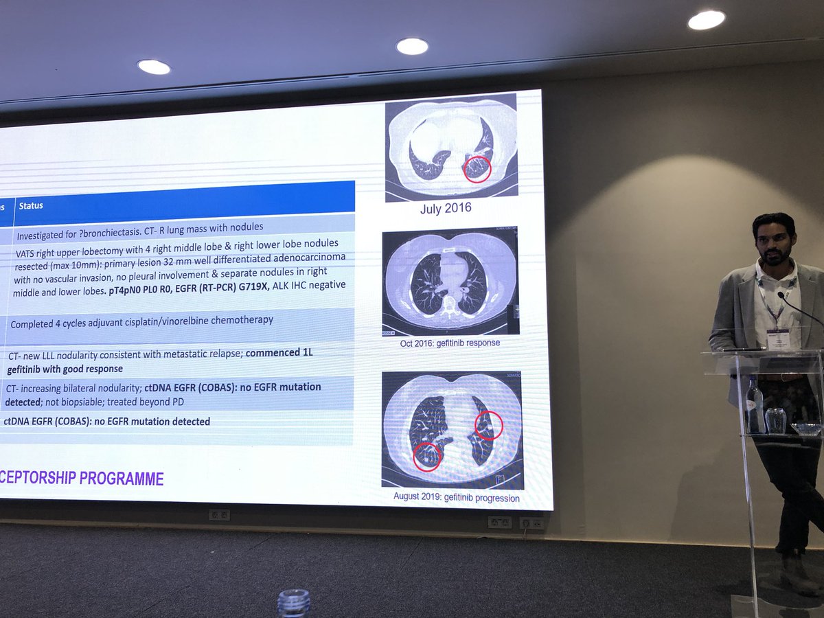 Superb case studies presented by our young oncologists during this ESMO Lung preceptorship, always a great time for sharing! <a href="/myESMO/">ESMO - Eur. Oncology</a>