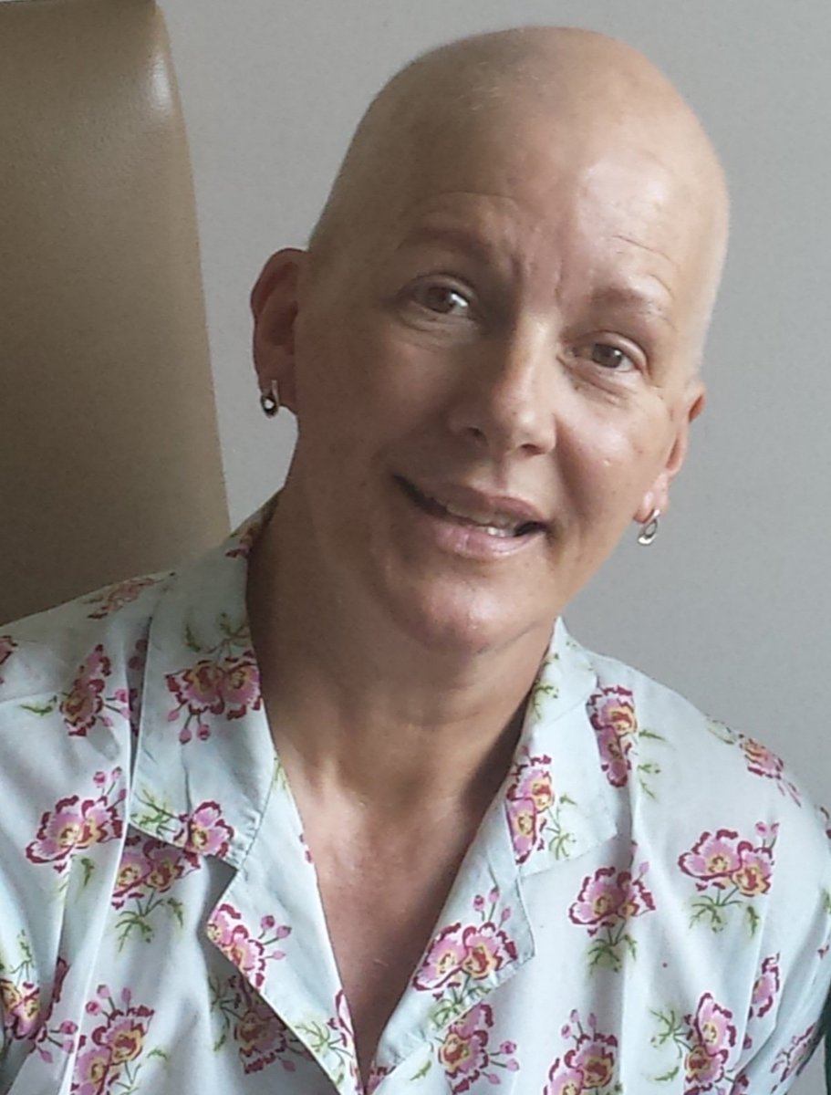 Clear Mammograms 2010, 2011, 2013, 2015 - 6 months later
7cm Breast Cancer December '15
Missed on 4 Mammograms 
#BreastCheck say
"Unseen with Learning Points"
Please sign ⬇️ Petition because 
Breast Cancer is missed in Dense Breasts 
chng.it/B4QC9WWQFR