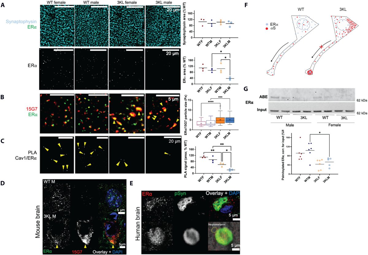ScienceofPD's tweet photo. New research from @tmoors1 &amp; colleagues reports that increased palmitoylation improves estrogen receptor  alpha–dependent hippocampal synaptic deficits in a mouse model of synucleinopathy; ML348 (de-palmitoylation inhibitor)⬆️ERα &amp; soluble αsyn homeostasis
https://t.co/2Yk2w3zRtO https://t.co/XrWxjrrafn
