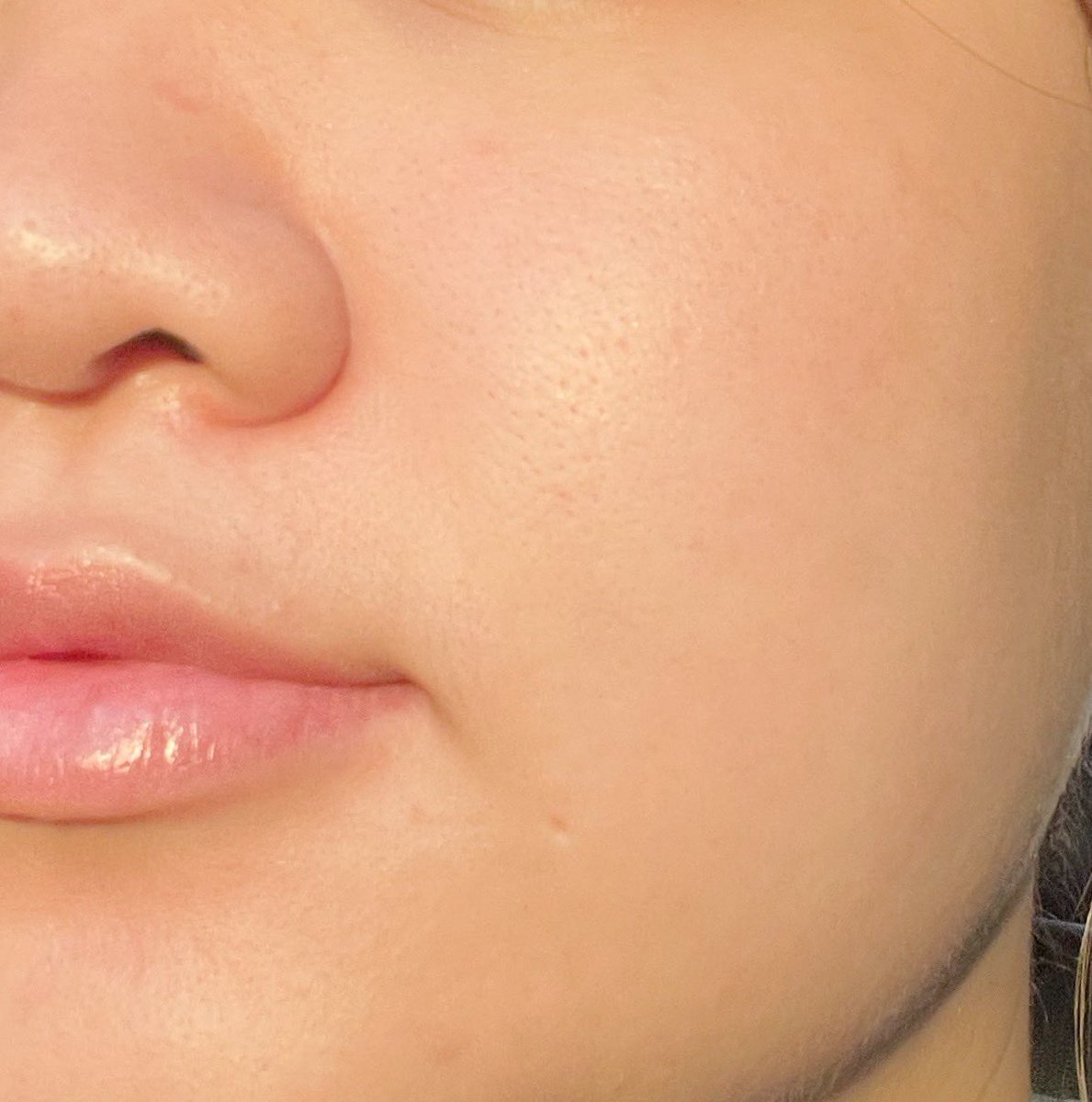 #INNISFREEVitaC ตัวใหม่อย่างแจ่ม! เป็นส่วนผสมที่ลงตัวจาก วิตามินซี+ชาเขียว ช่วยให้ผิวกระจ่างใสแบบเห็นผลมากยิ่งขึ้น พี่หมอกลางมาให้ความรู้เพิ่มด้วย ตัวแคปซูลวิตามินสีส้มๆในเนื้อเซรั่ม กักเก็บวิตามินซีละลายในไขมัน(ปกติวิตามินซีละลายในน้ำ) และเอนไซม์ชาเขียว ผลัดเซลล์ผิวอย่างอ่อนโยน