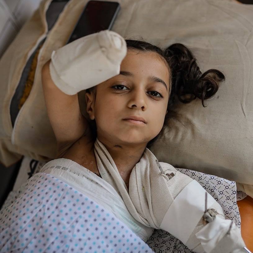 10-year old Ghina lost her hand when #Israel bombed her home. Because that's what israel does, with impunity... for now.