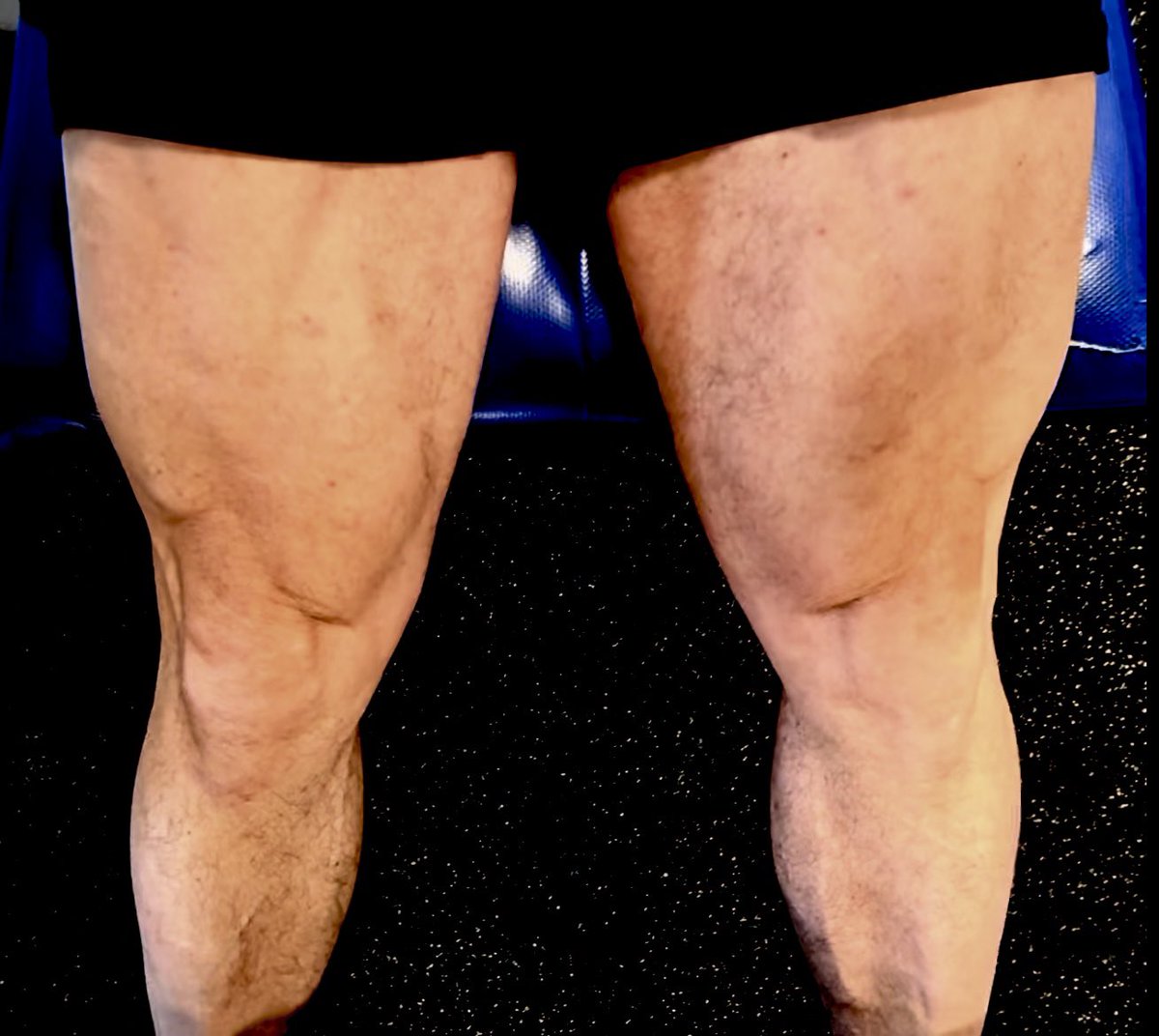 PastorPaulB1's tweet photo. Saturday leg session in the books! Leg press, extensions (getting that Time Under Tension), hamstring curls, calf raises and goblet squats. Thankful to be feeling well! #cancersurvivor #multiplemyeloma #almost65 #doworkson https://t.co/csLSBx7ZIs