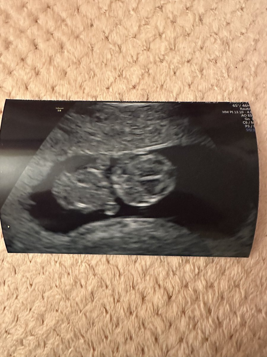 FansOfMH's tweet image. I'm set to become an uncle for the very first time! My sister is currently 11 weeks pregnant.

My future niece or nephew is due on 8th June 2024! 🩷🥰