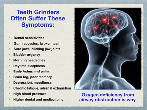 Dr_JohnNguyen's tweet photo. If you have worn teeth and other signs of grinding and clenching your teeth, it may be a big sign of an airway obstruction. https://t.co/h4pAEcVDdh