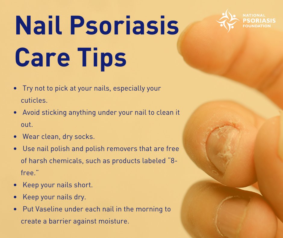 Psoriatic Nails | Obgyn Key