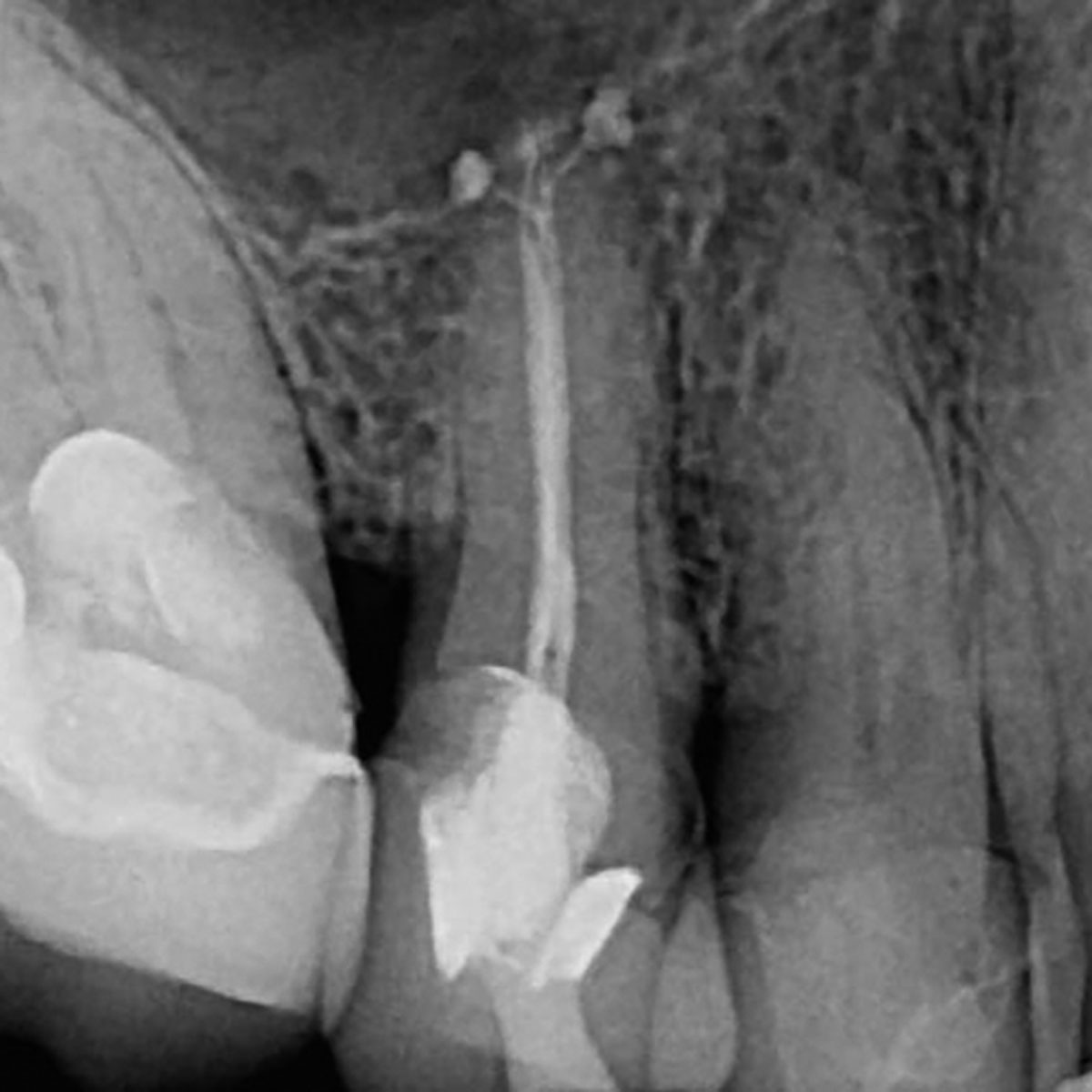 EndoPracticeUS's tweet photo. Dr. James A. Smith is always looking to simplify the root canal process. His office has found great efficiency with GentleWave®. Now, they have an addition that improves the process even more:

CleanFlow™ Technology.

Read more: https://t.co/Alz3W2jfTW https://t.co/ZnUTR0uWA8