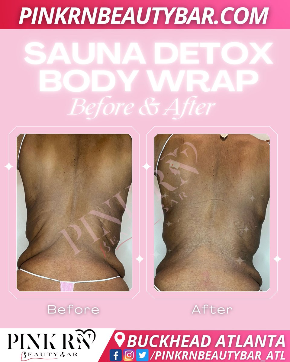 pinkrnbeautybar's tweet photo. #slimmingtea #purebeautyproducts #beautyupdates #transformativebeauty #beautybarexperience #atlantanonsurgical #buckheadlife #buckheadlifestyle #atlantadayspa #atlantaskinhealth https://t.co/CWvhNjlg05