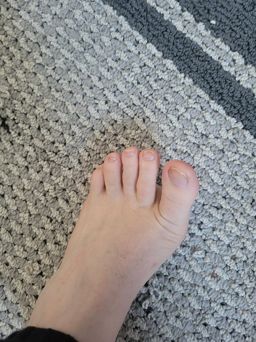 SoleToeSmith's tweet photo. #FootLove #footfetish #feet #footfetishnation #toes  #foot  #feetporn #feetlovers #feetworship #feetpics  #barefeet  #barefoot #soles
#feetcontent #FeetFetishCommunity #feetfinder
#feet_lover
#feet_pic #feet_lover https://t.co/kiFrXCohiE