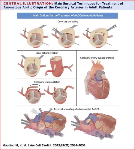 SeguraCardio's tweet photo. ๐Management of Adults w/ Anomalous Aortic Origin of the Coronary Arteries:
#StateOfTheArt #Review @JACCJournals #AAOCA #CHD https://t.co/5Ej7OhkSXj