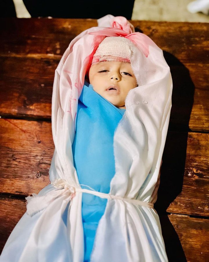 maluc63's tweet photo. Çocuk her yerde çocuk değildir
Çocuk Suriye’de Kayıptır
Yemen’de Açtır
Gazze’de Şehittir
Afirka’da İşçidir
Afganistan’da Yaralıdır
Irak’ta Yetimdir,Öksüzdür
Doğu Türkistan’da Mazlumdur,Mağdurdur
Avrupa da Prenstir yada Prensestir
 #ZionistCensorship Elon Musk https://t.co/7BeGcoa9WA