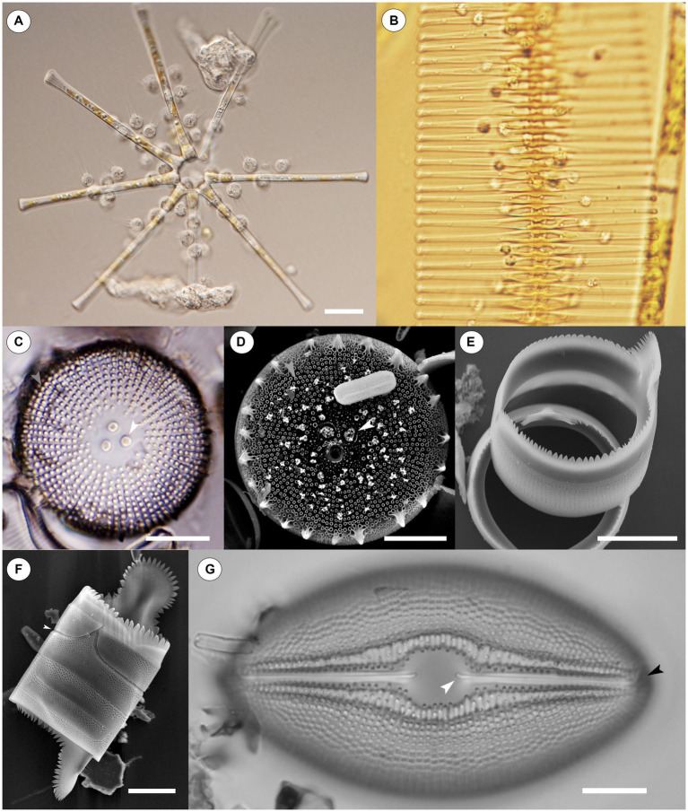 DrRabern's tweet photo. Great review of #chytrids on #diatoms! And the first citation of @kseto_chytrid's excellent work on unculturable chytrids! #fungi #aquatic #parasites
https://t.co/ogV5cXt8At https://t.co/wJOD1WMMag