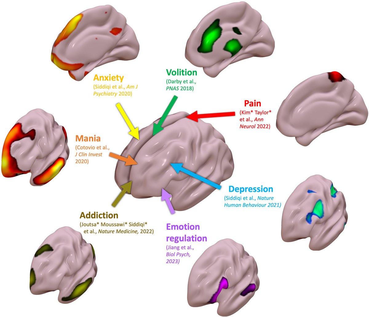 Out now in @BiologicalPsyc1 @SOBP Our latest thoughts on 'Targeting symptom-specific networks with TMS,' with @foxmdphd of @BWHNeurology Thanks to @harvardbrainsci @BrighamResearch @Brain_Circuits biologicalpsychiatryjournal.com/article/S0006-…