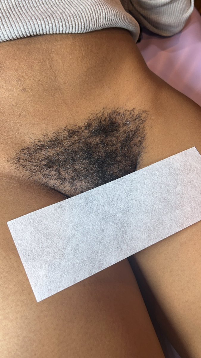 joraindenise's tweet photo. this client hasn’t been waxed since June.
before & after 🙂 https://t.co/7PHI4sZY0V