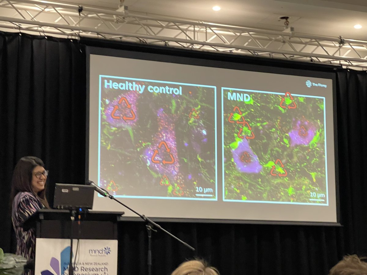 turnerMNDlab's tweet image. Fantastic big ideas presentations from our enthusuastic #MND #ALS research team at the Aus NZ MND Symposium in Wollongong. New treatment angles harnessing cell recycling, antioxidant defence and inflammation generously funded by @MND_RIA @FightMND Great conference! #ANZMNDSym2023