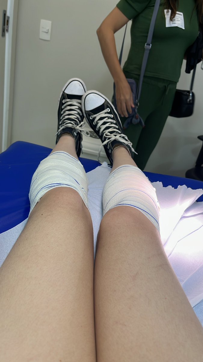 autoranya's tweet photo. Pessoal, faz tempo que não venho aqui, mas é a minha única conta aberta. Hoje 18/11 eu fui no Estádio Nilson Santos para o show da Taylor Swift e saí com 3 queimaduras de segundo grau.

As placas de metal que cobriam o chão da pista premium viraram uma CHAPA QUENTE com os 40°C. https://t.co/rKDwEPxRrM