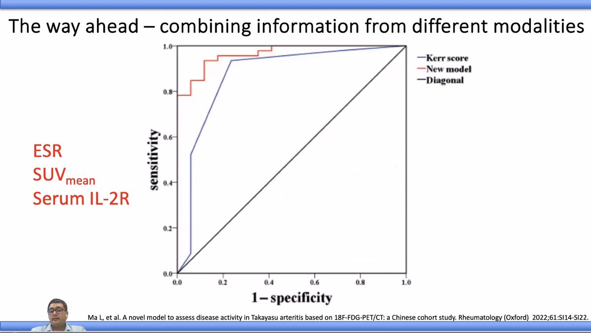 TAK updates by @DurgaPrasannaM1 sir

🔸Triphasic pattern- only 19% of patients 
🔸✖️ pulses ➡️✔️ pulses in 1/6th of patients with steroid 
🔸APRs - poorly reflect disease activity 
🔸ESR+SUV (mean)+ serum IL-2R: promising combination biomarker 

#IRACON2023
#Rheumtwitter