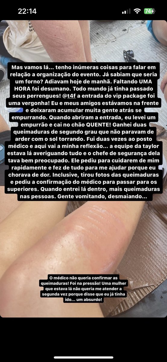 choquei's tweet photo. 🚨ATENÇÃO: Fãs de Taylor Swift que estiveram ontem (18) no estádio Nilton Santos sofreram queimaduras de segundo grau na perna após caírem em placas de metal que estavam no chão na pista do evento. https://t.co/1AYpjcoK1g