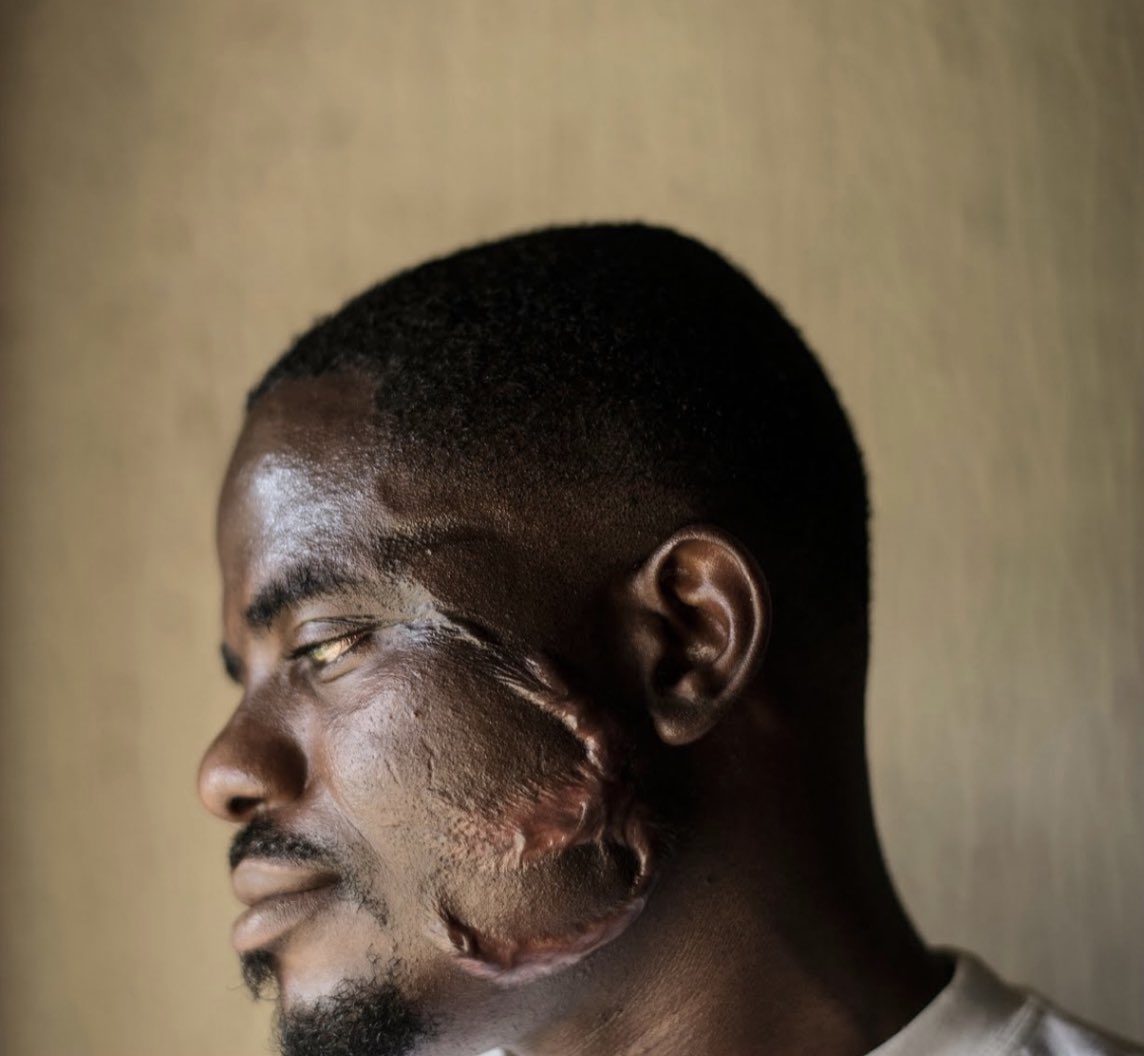 I don’t think people understand the extent of slavery in North Africa so I’m going to start sharing stories I’ve read over the years: 

On his way to Europe from Nigeria, Sunday, had to pass through Libya. There, a taxi driver sold him to an Arab for $200.