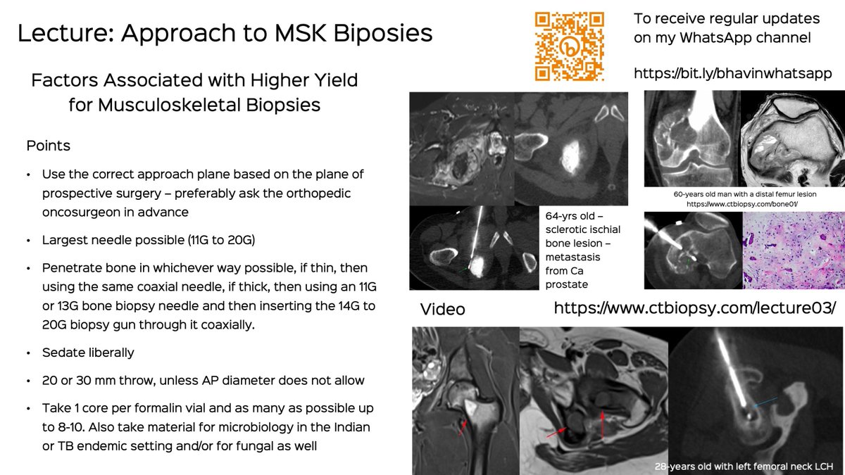 bhavinj's tweet photo. Lecture: Approach to MSK Biopsies - Bone Biopsies
How to maximize the technical and diagnostic yield
https://t.co/ijAzgwm462
#ctbiopsy #irrad #bonebiopsy #spinebiopsy #lecture https://t.co/Rl7BgJoEkr