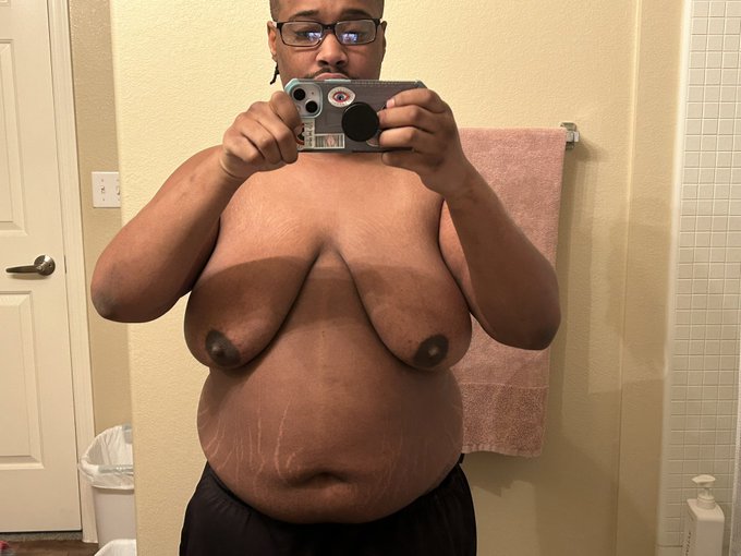 I am officially PostOp!  Boobies are gone forever!  #topsurgery #ftm #TransAwarenessWeek #transman #transjoy<a href="/tag/ftm"class="tags"><span>#ftm</span></a><a href="/tag/transawarenessweek"class="tags"><span>#transawarenessweek</span></a><a href="/tag/transman"class="tags"><span>#transman</span></a><a href="/tag/topsurgery"class="tags"><span>#topsurgery</span></a>