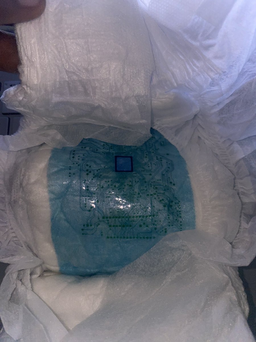 FREE DISTRIBUTION OF SMART BLADDER DEVICE.
This is to inform the general public most especially those having urinary incontinence, vesicovaginal fistula, diabetes-induced polyuria, and bed wetting in children, that there shall be FREE distribution of smart bladder devices….